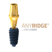 ایمپلنت انی ریج مگاژن | AnyRidge Implant System MegaGen